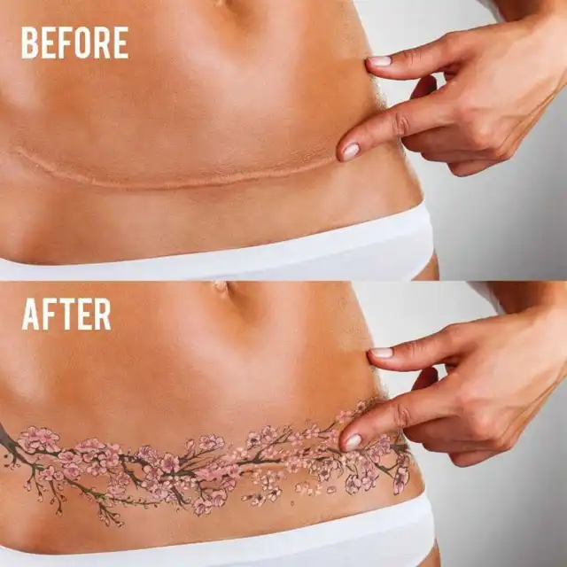 Great floral cherry blossom stretch mark