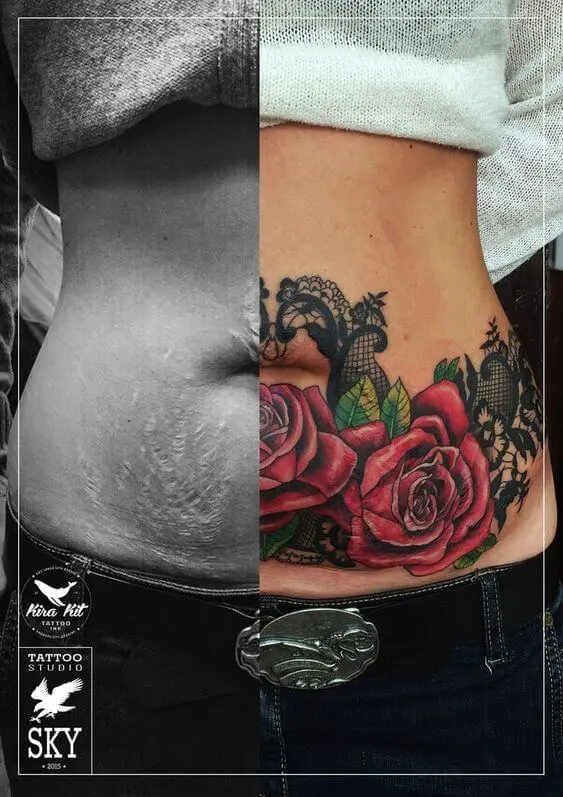 Section C stretch marks cover up tattoos
